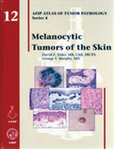 Melanocytic Tumors of the Skin, Boeken, Studieboeken en Cursussen, Verzenden