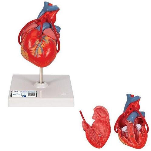 Anatomie model hart met bypass, 2-delig, 19x12x12 cm, Sport en Fitness, Overige Sport en Fitness, Verzenden