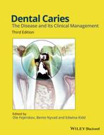 Dental Caries 9781118935828, Boeken, Verzenden, Zo goed als nieuw