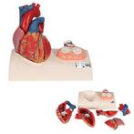 Anatomie model hart, 5-delig, Nieuw, Verzenden