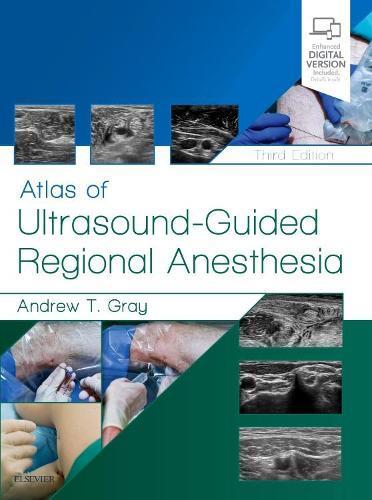 Atlas of Ultrasound-Guided Regional Anesthesia, Boeken, Studieboeken en Cursussen, Verzenden