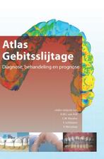 Atlas gebitsslijtage 9789036805377, Verzenden, Zo goed als nieuw