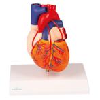 Anatomie model hart met bypasses, 2-delig, 14x8x8 cm, Nieuw
