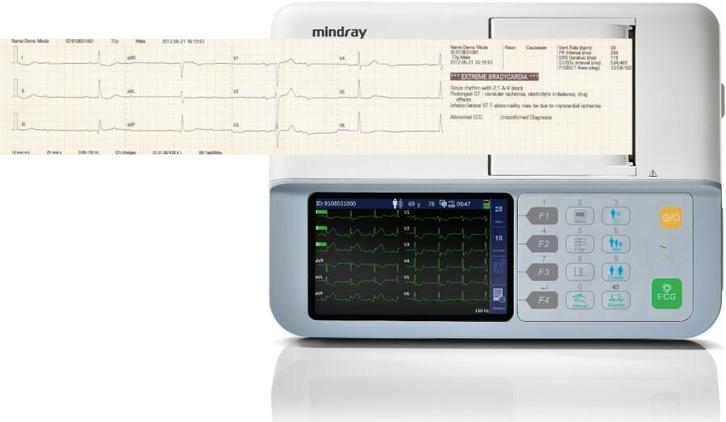 Mindray BeneHeart R3 ECG 12 leads, Diversen, Verpleegmiddelen, Nieuw, Verzenden