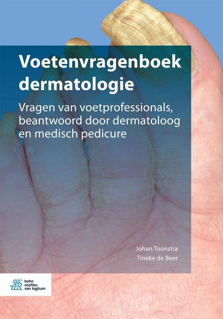 Voetenvragenboek dermatologie 9789036818247 Tineke de Beer, Boeken, Wetenschap, Gelezen, Verzenden