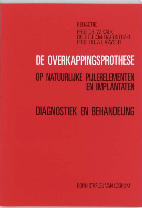 De overkappingsprothese op natuurlijke pijlerelementen en, Boeken, Wetenschap, Gelezen, Verzenden