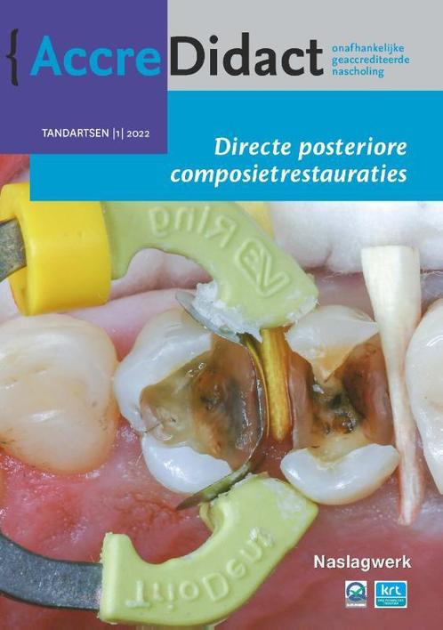 Directe posteriore composietrestauraties / AccreDidact /, Boeken, Wetenschap, Zo goed als nieuw, Verzenden