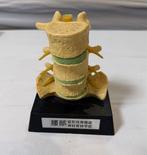 Lesmateriaal - Anatomical Model – Lumbar Spine (Pathological