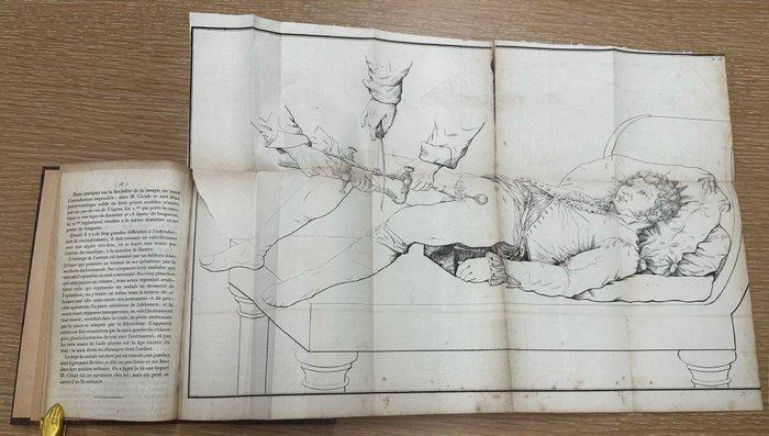 Docteur Civiale - Précis de la Lithotritie - 1827, Antiek en Kunst, Antiek | Boeken en Bijbels