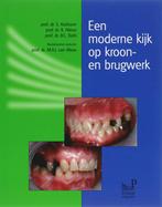 Een moderne kijk op kroon- en brugwerk 9789085620198, Boeken, Verzenden, Gelezen