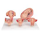 Anatomie model zwangerschap (serie van 5 modellen), Nieuw, Verzenden