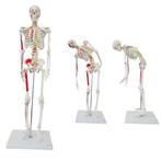 Anatomie model menselijk skelet met origo en insertie van..., Verzenden, Nieuw
