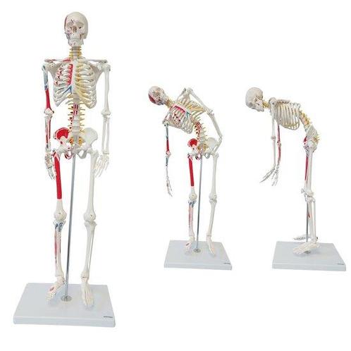Anatomie model menselijk skelet met origo en insertie van..., Sport en Fitness, Overige Sport en Fitness, Verzenden