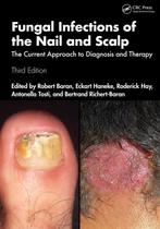 9781032464305 Fungal Infections of the Nail and Scalp, Boeken, Studieboeken en Cursussen, Verzenden, Zo goed als nieuw