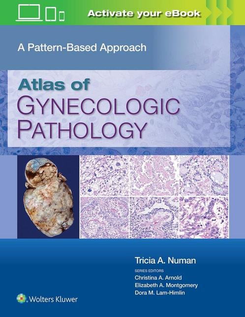 9781975124762 Atlas of Gynecologic Pathology, Boeken, Studieboeken en Cursussen, Nieuw, Verzenden
