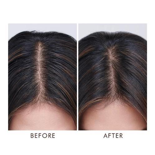Moroccanoil Oily Scalp Treatment (Haarolie), Sieraden, Tassen en Uiterlijk, Uiterlijk | Haarverzorging, Nieuw, Verzenden