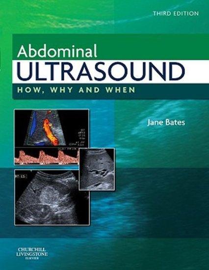 Abdominal Ultrasound | 9780443069192, Boeken, Studieboeken en Cursussen, Verzenden