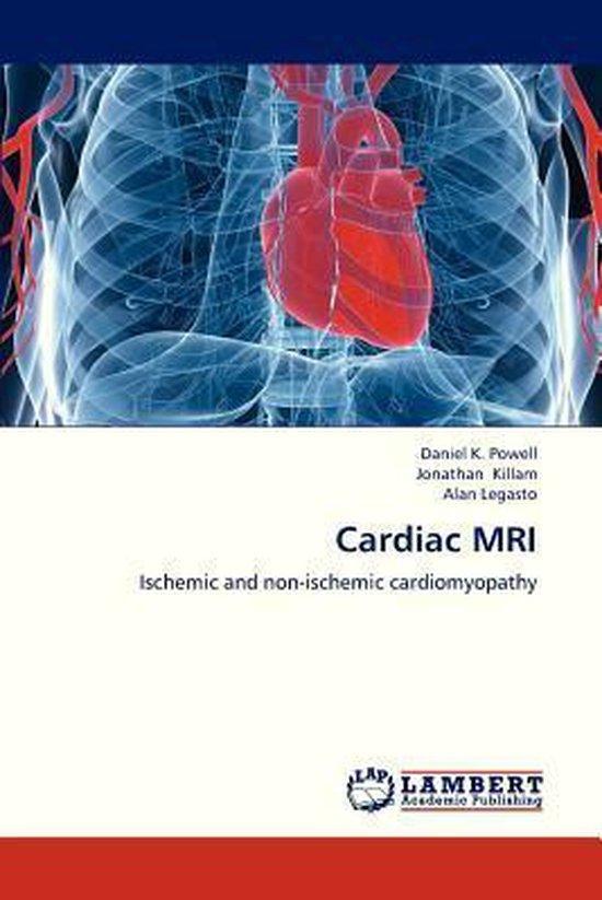 9783659325861 Cardiac MRI Powell Daniel K, Boeken, Studieboeken en Cursussen, Nieuw, Verzenden