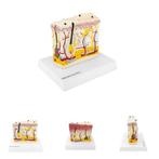 Anatomie model huid met psoriasis, Verzenden, Nieuw