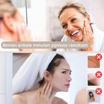 Wenkbrauw Trimmer Gezichtsontharing Apparaat Dames -, Sieraden, Tassen en Uiterlijk, Uiterlijk | Gezichtsverzorging, Ophalen of Verzenden