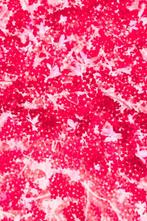 Viet Ha Tran - Red blossoms