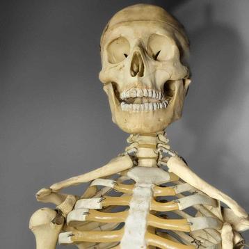 man Volledig skelet met schedel - Scheletro anatomico - 170 beschikbaar voor biedingen