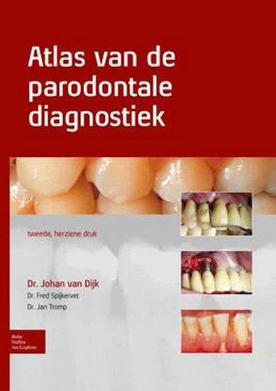 Atlas van de parodontale diagnostiek | 9789031388097, Boeken, Studieboeken en Cursussen, Verzenden