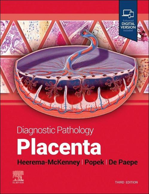 9780443116544 Diagnostic Pathology- Diagnostic Pathology:..., Boeken, Studieboeken en Cursussen, Nieuw, Verzenden