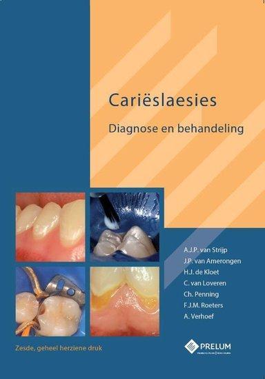 Carieslaesies | 9789085621300, Boeken, Studieboeken en Cursussen, Verzenden