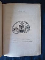 Dr. Charles Morel - Le Cerveau - 1880