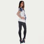 Op en Top Zwanger Zwangerschapslegging Positielegging Claudi, Verzenden, Nieuw