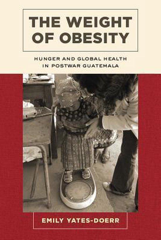 The Weight of Obesity 9780520286825 Emily Yates-Doerr, Boeken, Taal | Engels, Zo goed als nieuw, Verzenden