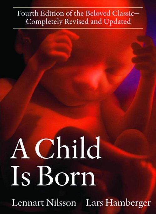 A Child Is Born 9780385337540 Lennart Nilsson, Boeken, Overige Boeken, Gelezen, Verzenden
