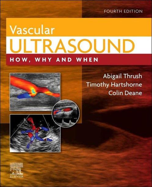 9780702046568 Vascular Ultrasound Abigail Thrush, Boeken, Studieboeken en Cursussen, Nieuw, Verzenden