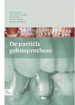 De partiele gebitsprothese 9789031375752, Verzenden, Zo goed als nieuw