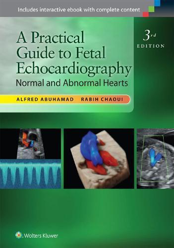 A Practical Guide to Fetal Echocardiography, Boeken, Studieboeken en Cursussen, Verzenden