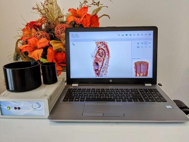 Bioresonantie te koop, Diensten en Vakmensen, Alternatieve geneeskunde en Spiritualiteit, Acupunctuur, Homeopathie, Overige, Geeft ook workshops