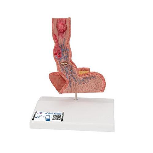 Anatomie model slokdarm, Sport en Fitness, Overige Sport en Fitness, Verzenden