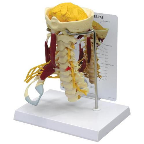 Anatomie model cervicale wervelkolom met spieren, Sport en Fitness, Massageproducten